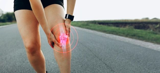 Gewrichtsproblemen en peesontstekingen Sportieve vrouw die tijdens het hardlopen een knie-ongeluk kreeg
