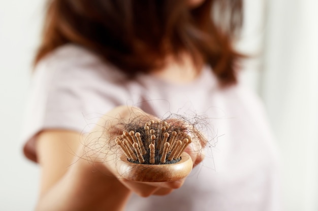 Gezondheidsproblemen, haarverlies bij vrouwen