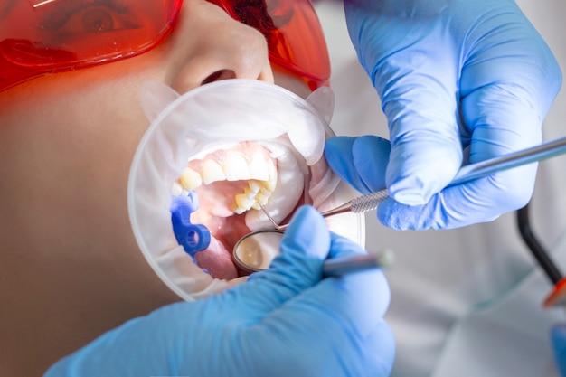 Photo girl on examination at the dentist. the doctor uses a mirror on the handle and a boron machine