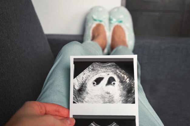 Photo the girl is holding a snapshot of an ultrasound twin in the fourth week of pregnancy.