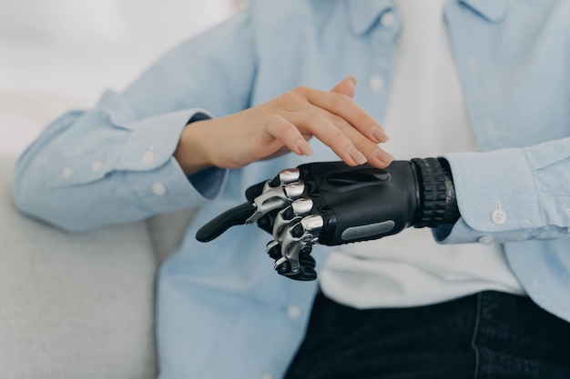 Girl is setting up her bionic hand and pressing buttons Young woman with artificial arm at home