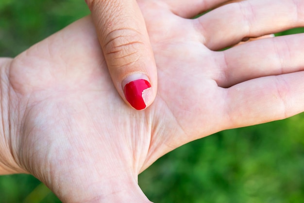 The girl shows a bad old manicure Overgrown nail polish broken nail Manicure correction old manicure Nail care it's time to go to the salon