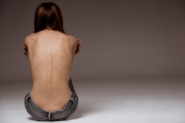 Una ragazza con anoressia si voltò indietro, colonna vertebrale e costole visibili.