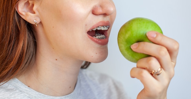 Una ragazza con le parentesi graffe sui denti vuole mordere una mela verde. foto ravvicinate di denti e labbra. denti lisci da parentesi graffe. foto su sfondo chiaro e solido.