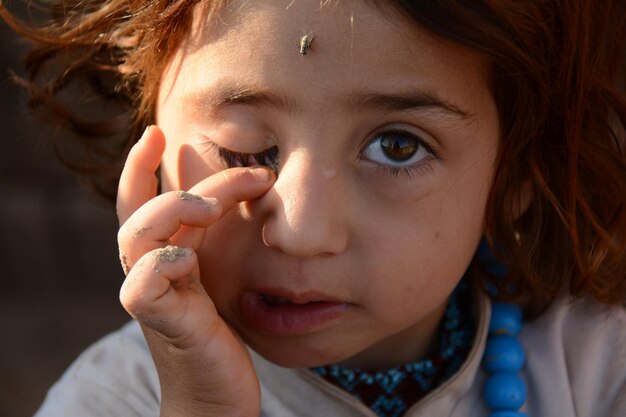 A girl with a fly on her nose