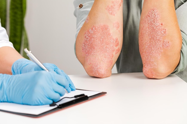 A gloved dermatologist examines the skin of a sick patient and records observations Examination and diagnosis of skin diseasesallergies psoriasis eczema dermatitis