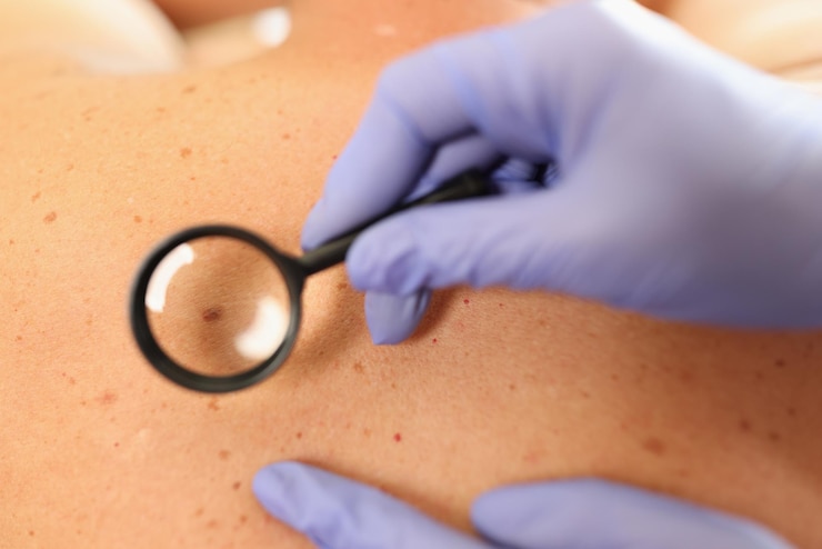 Photo gloved doctor dermatologist with magnifying glass examines skin of patient