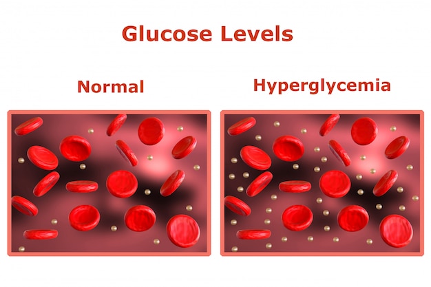 Foto livelli di glucosio nel sangue, tabella con livelli normali e un'altra tabella che indica il diabete. rendering 3d