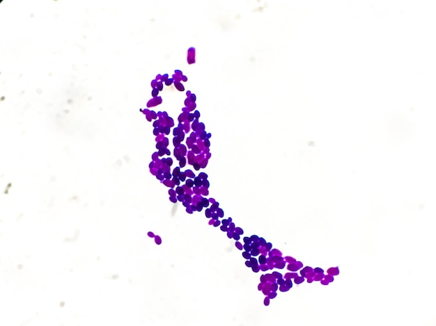 Candida 콜로니 또는 Candida albicans를 보여주는 현미경 보기에서 그람 염색