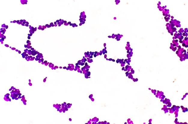 Gramkleuring onder microscopisch zicht met Candida-kolonie of Candida albicans