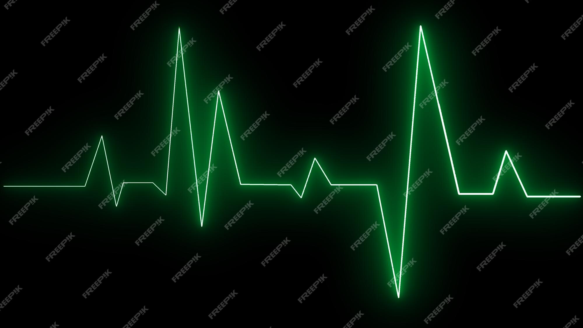 Animated heart beat with personal text Photo frame effect