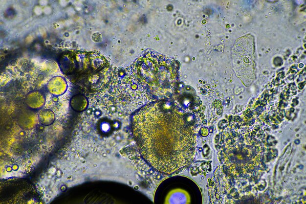Foto muco verde e tosse di catarro sotto il microscopio guardando le cellule dell'influenza e il muco freddo di un essere umano malato