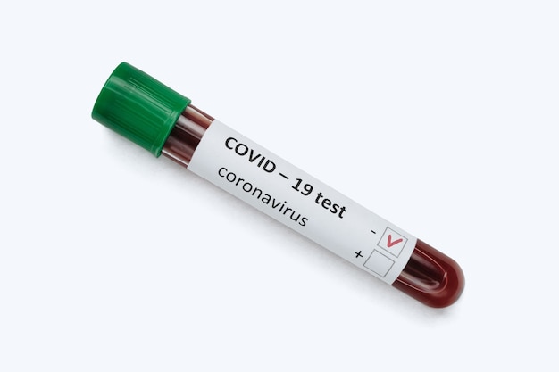 Green sample tube with patient blood, negative COVID19