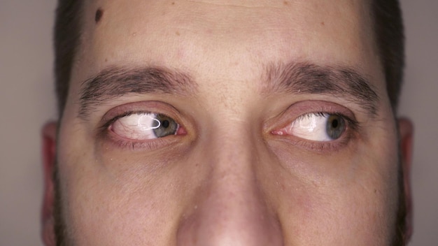 Groene ogen close-up met haarvaten Het concept van oogheelkunde en geneeskunde Bekeken in verschillende richtingen