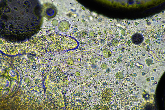 groene slijm en hoesten op slijm onder de microscoop kijken naar griepcellen en koude snot van een ziek mens