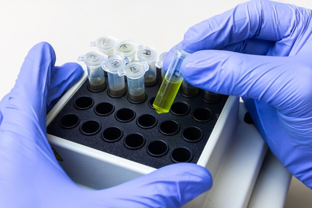 Groene substantie in microtube wordt in thermoschudbeker gedaan. DNA-experiment in biochemisch laboratorium