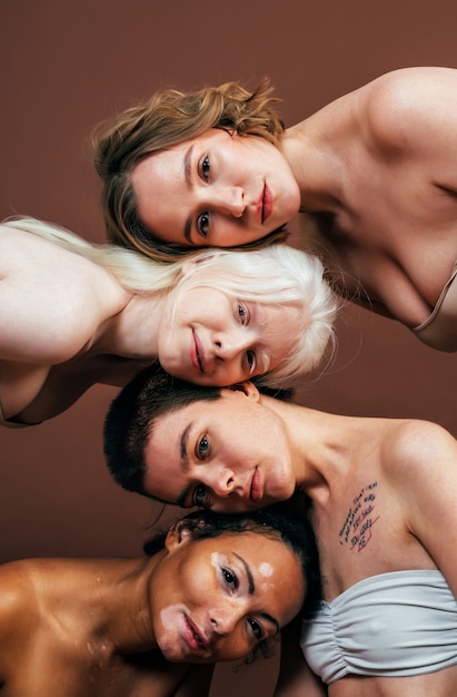 Groep multi-etnische vrouwen met verschillende soorten huid die samen in de studio poseren. Concept over lichaamspositiviteit en zelfacceptatie