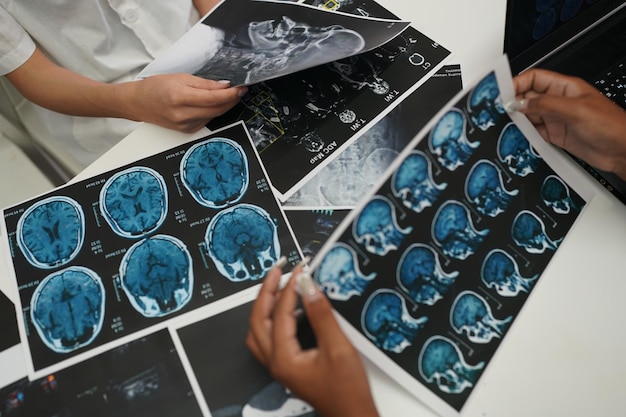 Photo group of doctors looking at xray on medical conference discussing issues