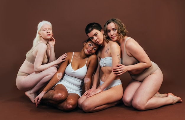 Group of multiethnic women with different kind of skin posing together in studio. Concept about body positivity and self acceptance