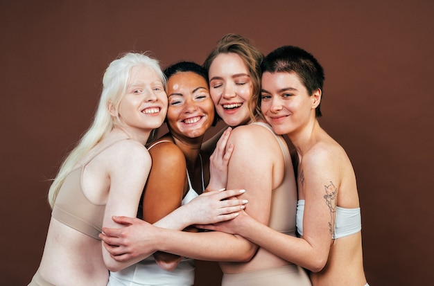 Group of multiethnic women with different kind of skin posing together in studio. Concept about body positivity and self acceptance