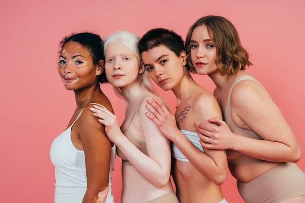 group of multiethnic women with different kind of skin posing together in studio