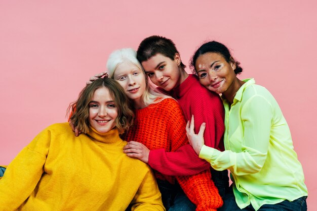 group of multiethnic women with different kind of skin posing together in studio