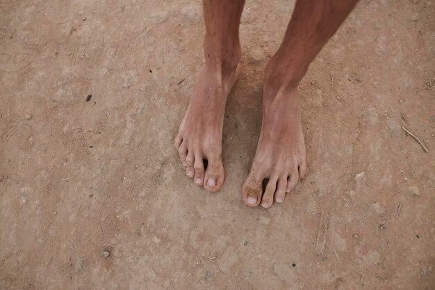 The guy stands on the sand barefoot feet close up