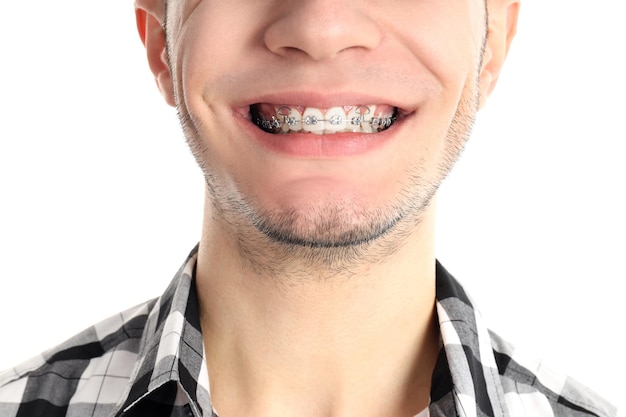Guy with braces isolated on white background close up