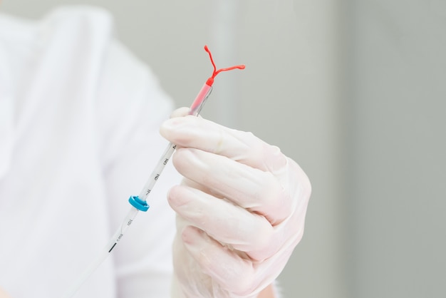 Photo gynecologist holding an iud birth control device