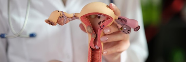 Foto il ginecologo mostra il modello del sistema riproduttivo femminile concetto di assistenza sanitaria e ginecologia femminile