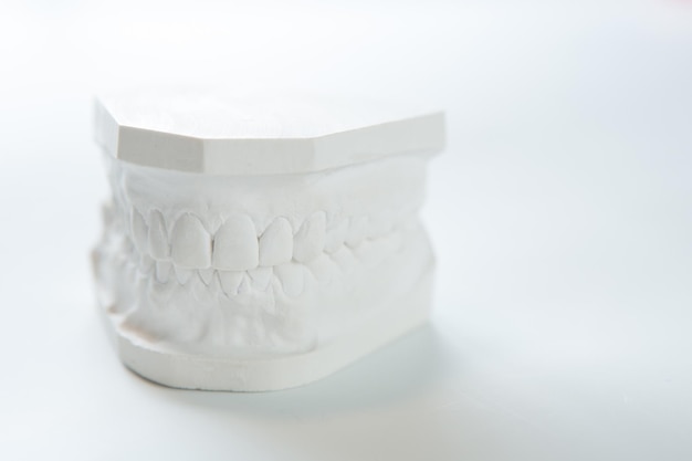 Gypsum model of human jaw on a white background