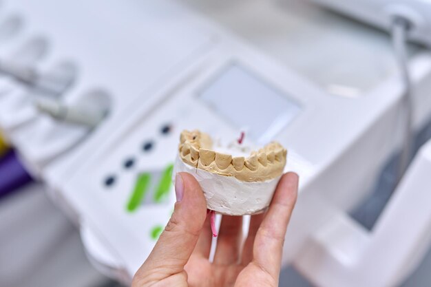 Gypsum model of teeth of jaw, dentist office background, orthopedics prosthetics dentistry concept