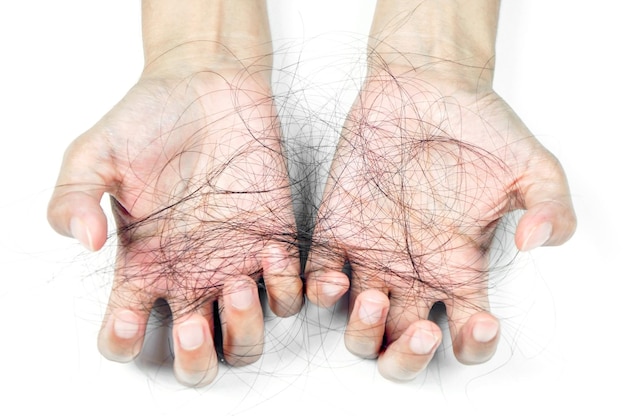 Hair fall in the womans hand