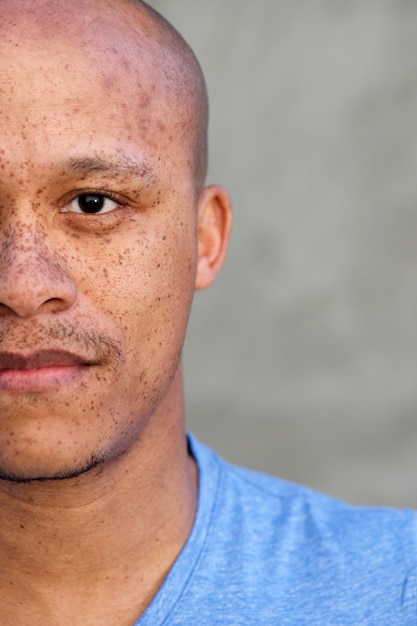 Half face african american man with freckles