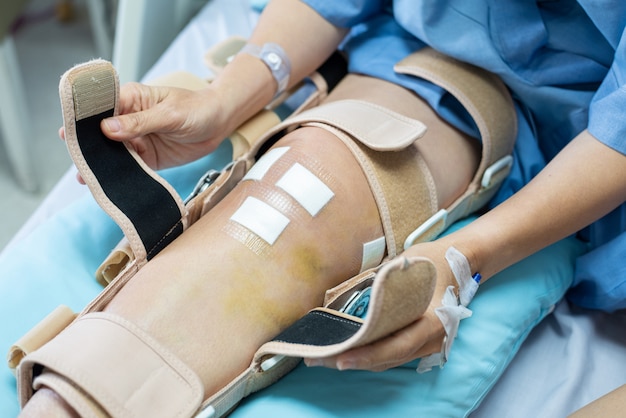 Hand of asian woman patient sit on bed in hospital try to wear knee brace support after do posterior cruciate ligament surgery.healthcare and medical concept.