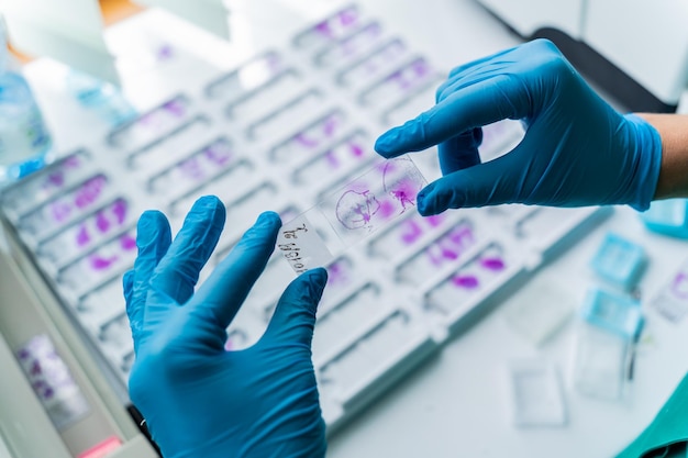 Hand in blue glove holding glass histology slides