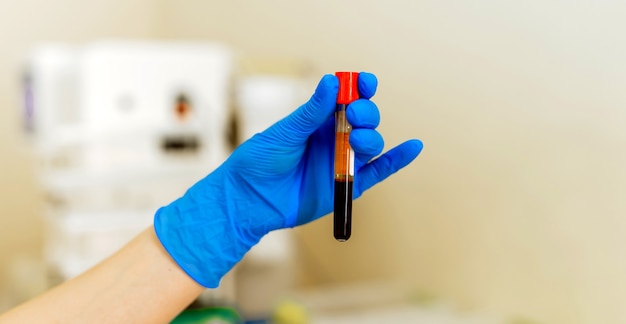 Hand in blue latex gloves holding blood sample vial in modern clinic background.