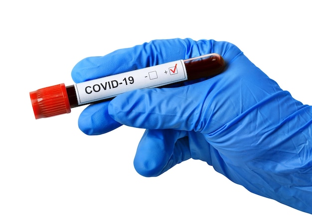 Hand in disposable glove isolated on white Tube with coronavirus test in hand