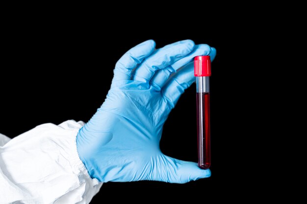 Hand of a doctor holding a bottle of blood sample