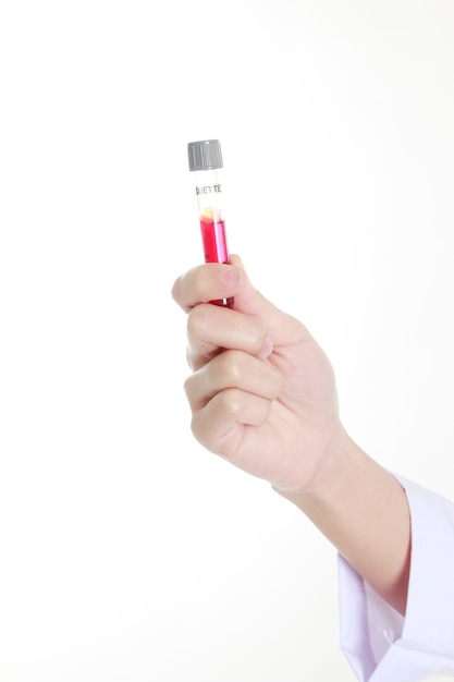 Hand of a doctor holding a bottle of blood sample