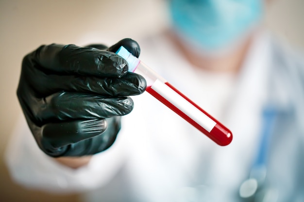 Hand of a doctor holding a bottle of blood sample.