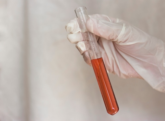 A hand in a glove holds a test tube with a red liquid