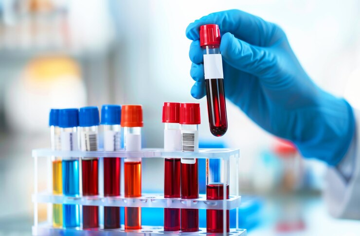 Photo hand holding a blood test sample in a medical laboratory