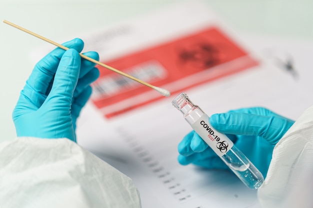 Hand holding COVID-19 swab collection kit, specimen sample testing process.