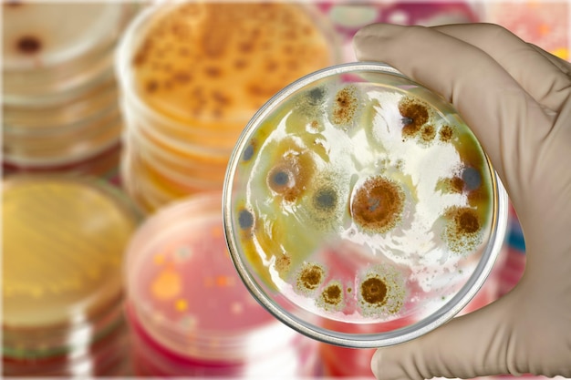 Hand holding Petri dish, close-up view