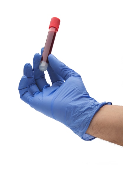 Photo hand holding test tube with blood isolated