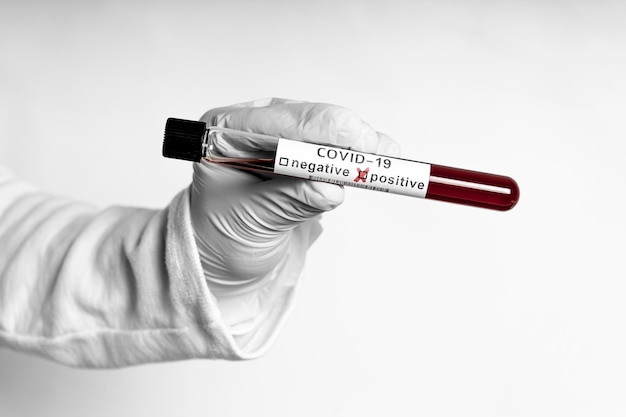 Hand holds a test tube containing a blood sample test tube for Covid19 coronavirus analyzing Laboratory testing patients sample