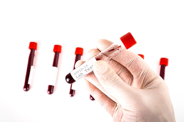 Hand holds a test tube containing a test sample