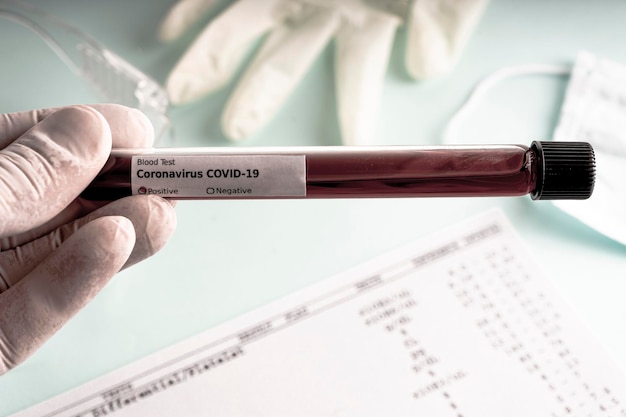 Hand holds a test tube containing a test sample