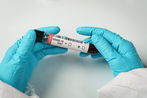 Hand holds tube of blood test samples of coronavirus